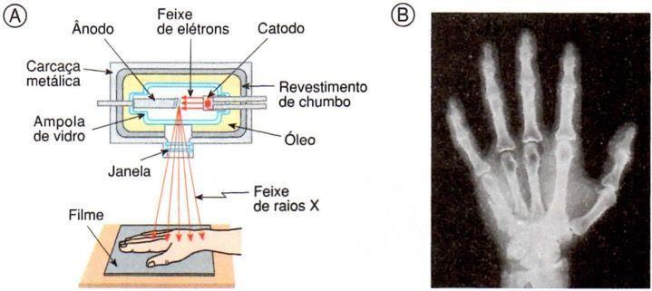 RADIOATIVIDADE Os efeitos da radioatividade, como energia causadora do dano, têm nos raios X, no rádio e na energia atômica