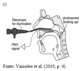 137 Para a realização da fotonasografia, conforme a Figura 38 (b, c), um fibroscópio (tubo flexível) foi introduzido por uma narina da participante, com uma fonte de luz colocada acima da abertura