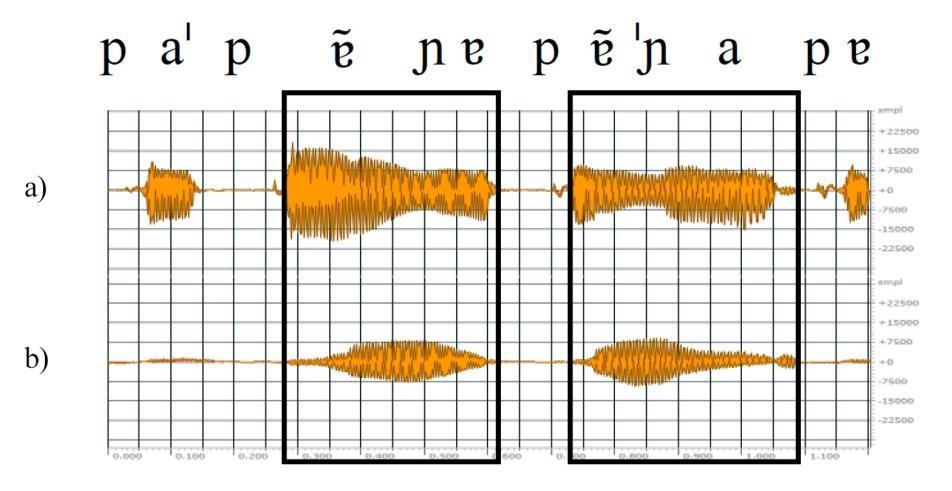 146 Figura 45 Logatomas [ ] produzidos por P3, com destaque para as regiões [ ] [ ] mostrando: em (a), forma de onda do sinal acústico, captada pelo microfone oral e, em (b), forma de onda do FAN,