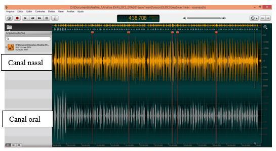 151 Figura 47 Canais oral e nasal no Ocenaudio, indicando a seleção do canal nasal para outiva do sinal acústico nasal. Fonte: Dados primários (2017).