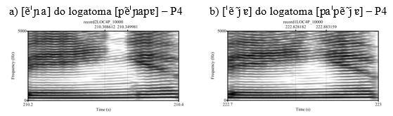 181 A diferença entre esses sons-alvo, segundo Silva (2014), é que na consoante ocorre obstrução da passagem do ar na cavidade oral causada pelo contato da língua na região palatal.