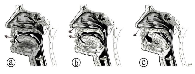 51 Figura 2 Ilustração esquemática da passagem do fluxo aéreo durante a produção de: (a) sons orais, incluindo vogais e consoantes; (b) vogais nasais e nasalizadas; (c) consoantes nasais.
