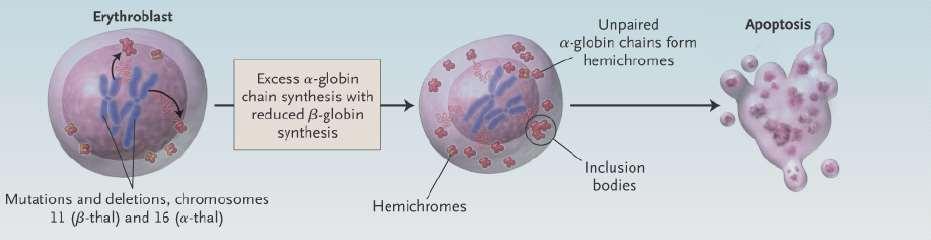 Fisiopatologia O excesso de globina alfa ocasiona a formação dos corpos de inclusão (corpos de Heinz) com lise