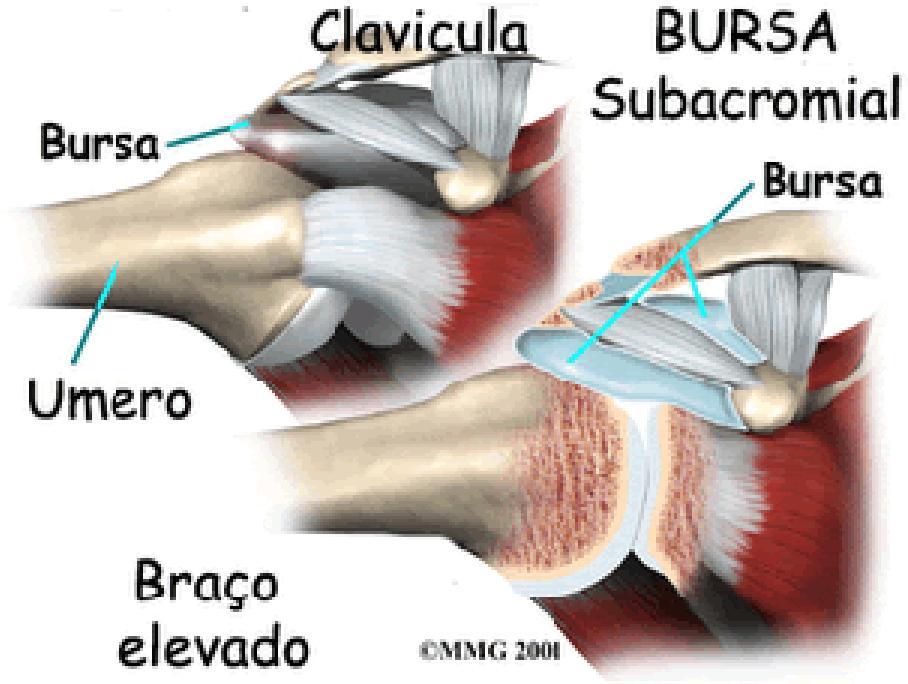 3 mobilidade e menor estabilidade, que pode ser atribuída à rasa fossa glenóide, à grande e redonda cabeça umeral 7. Fonte: http://ombroecotovelo.net/ombro-anatomia.html Figura 1: Anatomia do ombro 2.