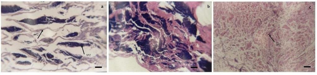 em hialinização (Escala: 10µm). Figura 6. Aspectos histológicos dos estádios de maturação dos testículos de H.