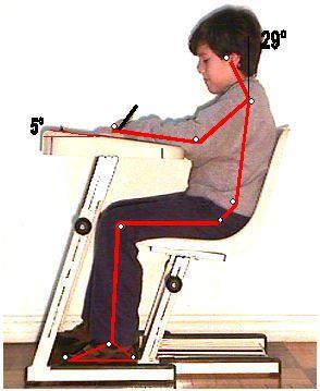 48 A atuação da fisioterapia nas escolas devera ter enfoque preventivos que incluam cuidados orientações posturais e correção da postura durante as atividades escolares. (FERNANDES et al., 2008).