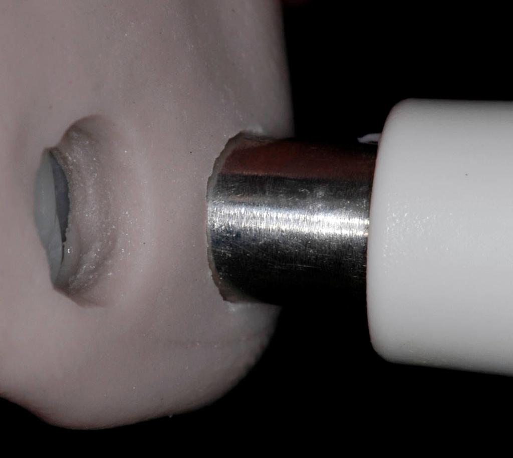 A ponta do aparelho foi posicionada sobre o terço médio da superfície vestibular dos dentes anteriores superiores, com o auxílio do dispositivo de silicone (FIG. 3).