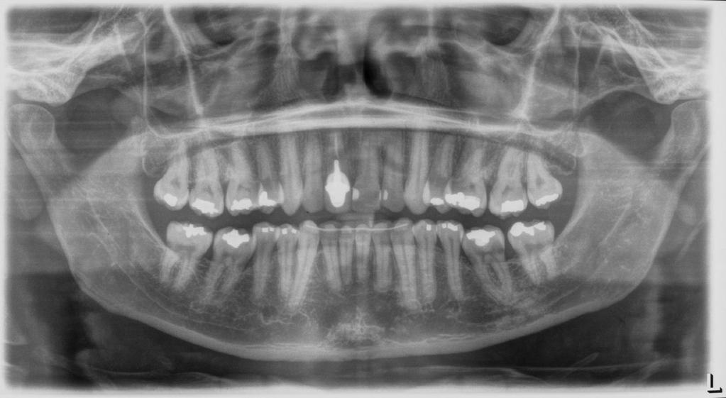 A) Extrabucal frontal final; B) Extrabucal frontal sorrindo; C) Fotografia extrabucal