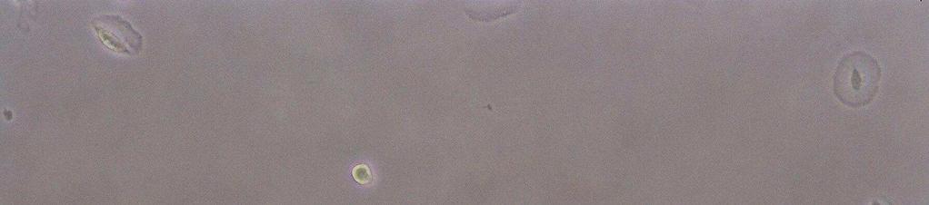 34 No terceiro dia de cultivo, após a retirada das células não aderentes, observouse nas amostras de CTM-AD uma