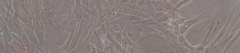 cultura de células-tronco mesenquimais de tecido