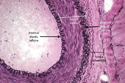2.3 - Fragmentação da lâmina elástica A lâmina elástica interna corresponde ao tecido elástico de transição entre túnicas dos vasos, nomeadamente entre a íntima e a média.