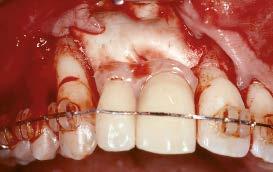 após a cirurgia. 7.5c Verificação da marcação.