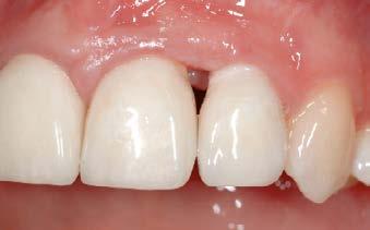higienização oral diária ( 7.6). 7.6 7.