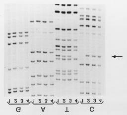 Figura 4. Seqüenciamento direto de um fragmento do gene da Arilsulfatase A. A seta indica o local da alteração T C que determina a mutação responsável pela doença.