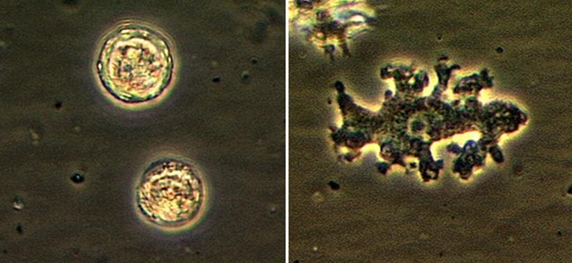 Agente etiológico Gênero Balamuthia: Organismo unicelular. Presente principalmente no solo. Foi declarada como uma nova espécie de ameba em 1993.