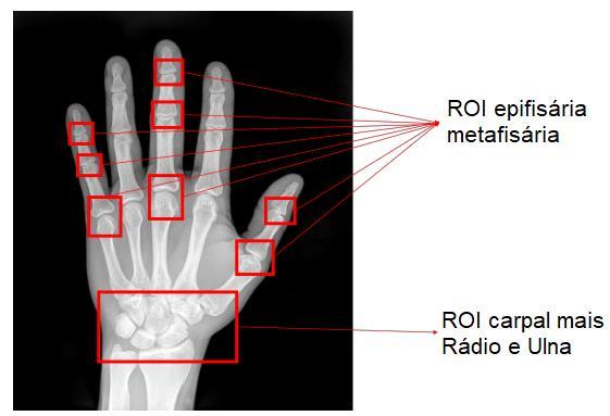 17 Figura 3 - Centros de ossificação carpal avaliados pelo método TW Fonte: Adaptado de Spampinato et al. (2017).