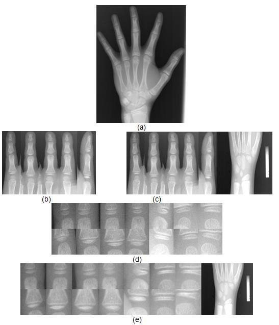 20 Pesquisar base de dados da radiografias carpais com anotação da estimativa da idade óssea feita por especialistas. Desenvolver método automático para a segmentação dos dedos.