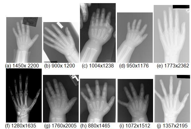 41 Figura 12 - Exemplos de imagens pouco padronizadas que compõem a base de dados com as dimensões de largura x altura respectivamente Fonte: Gertych et al. (2007).