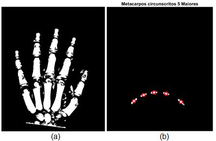 46 Figura 16 - (a) Ossos da mão binarizadas (b) Metacarpos obtidos da circunferência Fonte: Autoria própria. 3.2.