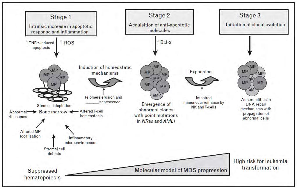 Modelo molecular de progressão da SMD