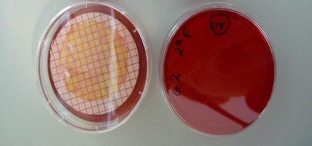 Parâmetros microbiológicos 15