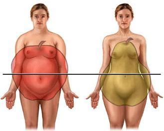 De acordo com a distribuição da gordura, a obesidade pode classificar-se em andróide ou ginoide.