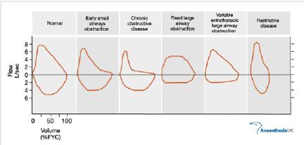 Espirometria