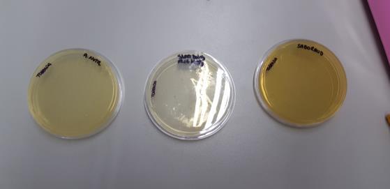 Figura 1: Placas de Petri amostra de Point bacon após uma semana em meio de cultura favorável ao crescimento de microrganismos.