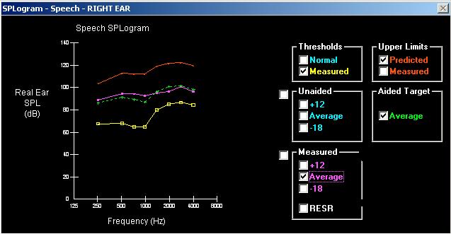 60 Os dados obtidos nas medidas com os AASI, tanto da orelha direita quanto da orelha esquerda, foram inseridos no software do DSL[i/o] 4.1 para a visualização do gráfico SPLogram referente à fala.
