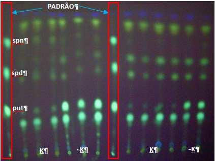 (espermidina + espermina) Con ncentração de putrescina (nmol g -1 )