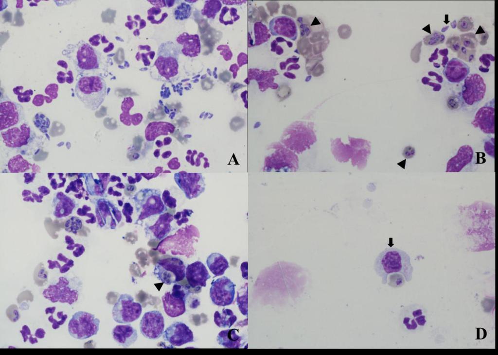 Cota et al. O líquido peritoneal apresentava aspecto turvo, coloração avermelhada, densidade 1.