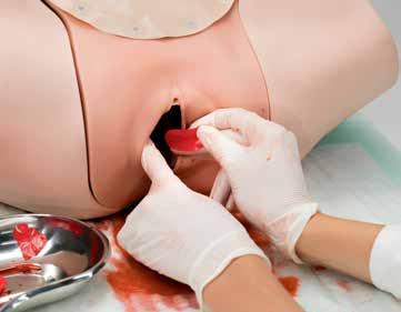 A simulação realista do tecido mole do Módulo do Simulador HPP permite que o útero pós-parto inflável seja