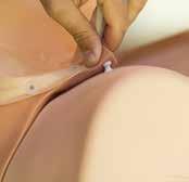 Parede abdominal com unidade vaginal A parede abdominal e a unidade vaginal são fixadas em conjunto com a unidade base por meio de fixadores invisíveis.