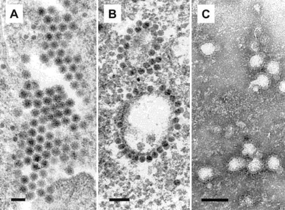 Alphavirus TRANSMITIDOS PELOS AEDES Alphaviruses Doença Distribuição geográfica Sindbis virus Vermelhidão, Artrite Europa Semliki Forest virus Vermelhidão, Artrite África O nyong nyong