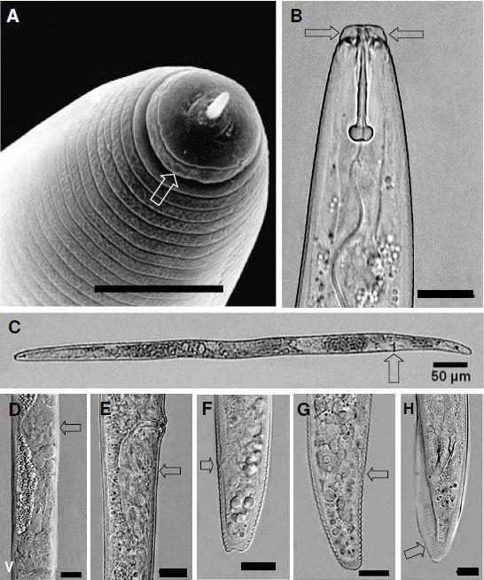 Figura 2. Principais caracteres morfológicos para identificação de Pratylenchus coffeae A) Eletromicrografia de varredura da região labial da fêmea, com dois anéis, e placa labial indivisa (seta).