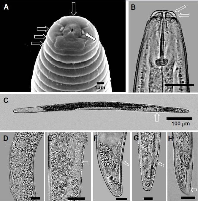 Figura 5. Principais caracteres morfológicos para identificação de Pratylenchus penetrans.