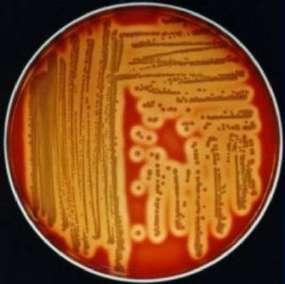 parahaemolyticus e Vibrio cambellii Caracterização