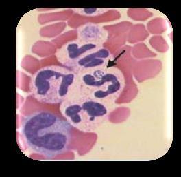 Anaplasma phagocytophilum 4,5% - 54,5% (Santos et al, 2009; Silva, 2010;