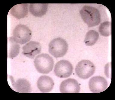 Mycoplasma haemocanis Observado em canis com diferentes taxas de infeção.