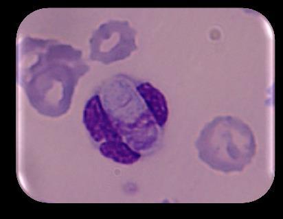 Hepatozoon canis Achados laboratoriais: ocasionalmente observado em esfregaços de sangue.