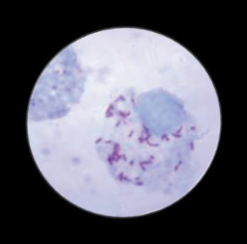 Babesia/Theileria Mycoplasma