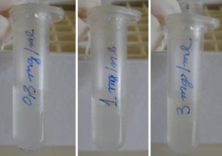 Material e Métodos 64 Figura 7: Fotos dos Eppendorfs contendo as três concentrações propostas para o 1ª ensaio dose-resposta.