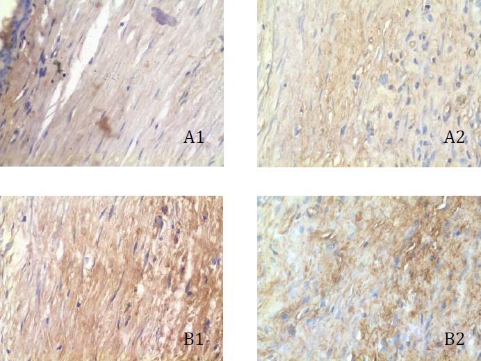 Resultados 89 Figura 16: Fotomicrografias da imuno-histoquímica para -actina do sítio cirúrgico, mostrando áreas adjacentes ao tubo de sylastic implantado.