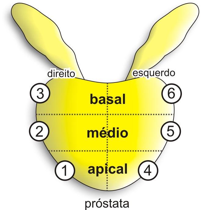 10 percentagem total de tumor, ambos obtidos na análise do material da biópsia, e estadiamento patológico da peça cirúrgica.