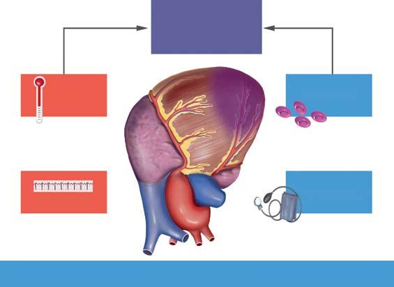 62 Libby et al. Inflamação, imunidade e infecção na aterotrombose JACC Vol. 72, No.