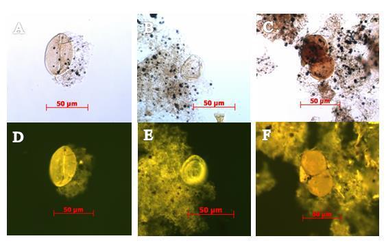 Figura 18- Fotomicrografias dos grãos de pólen em luz branca transmitida (LT) e modo