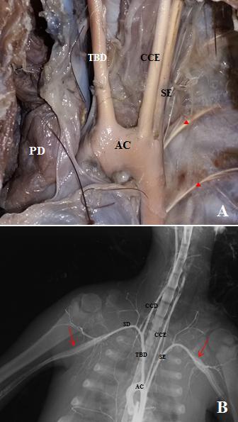 Ramos do arco aórtico... antímero direito com o corpo das vértebras torácicas. Em sua região média e caudal, liga-se dorsalmente com as costelas, seguindo as demais relações de sua fração inicial.