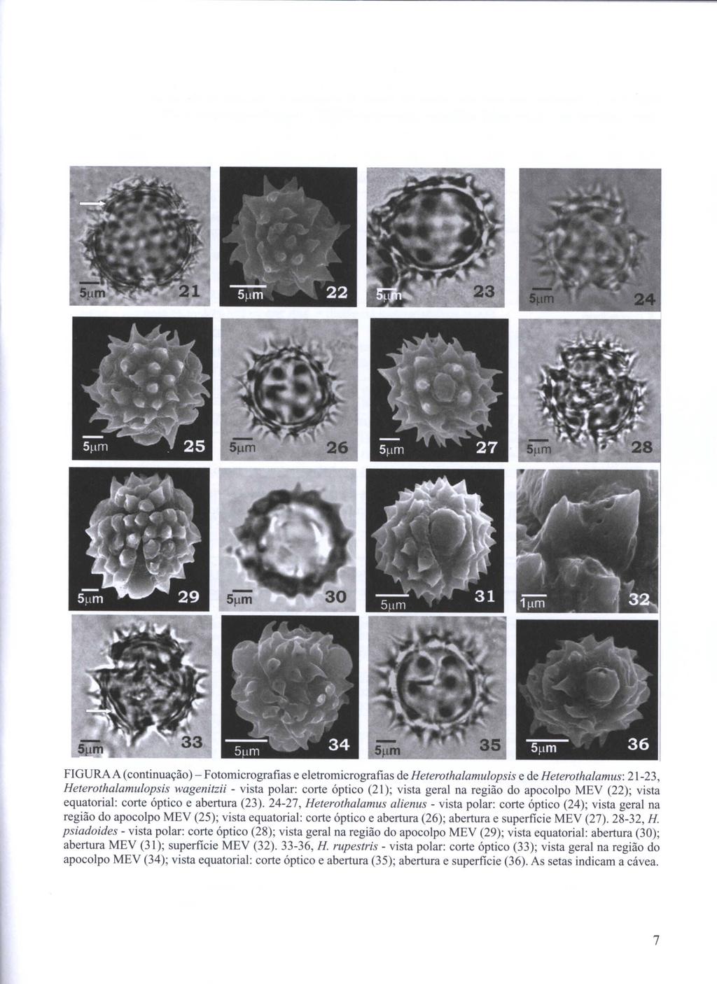 FIGURA A (continuação) - Fotomicrografias e eletromicrografias de Heterothalamulopsis e de Heterothalamus: 21-23, Heterothalamulopsis wagenitzii - vista polar: corte óptico (21); vista geral na