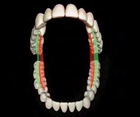 158 a b Fig 3-2-14 Vertentes observadas a partir da fase mesial.