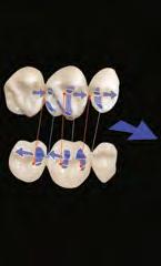 Os contatos dinâmicos também são chamados de padrão oclusal ou esquema oclusal.